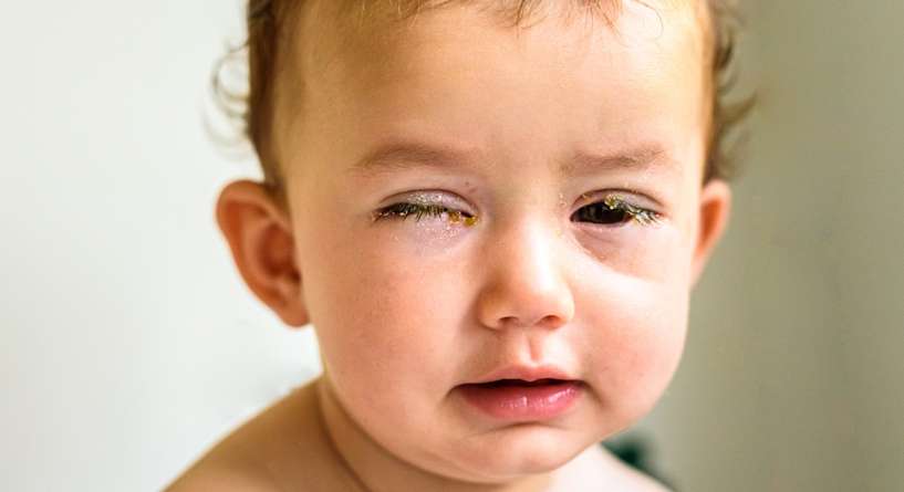 طفل يعاني من رمد العين الشديد
