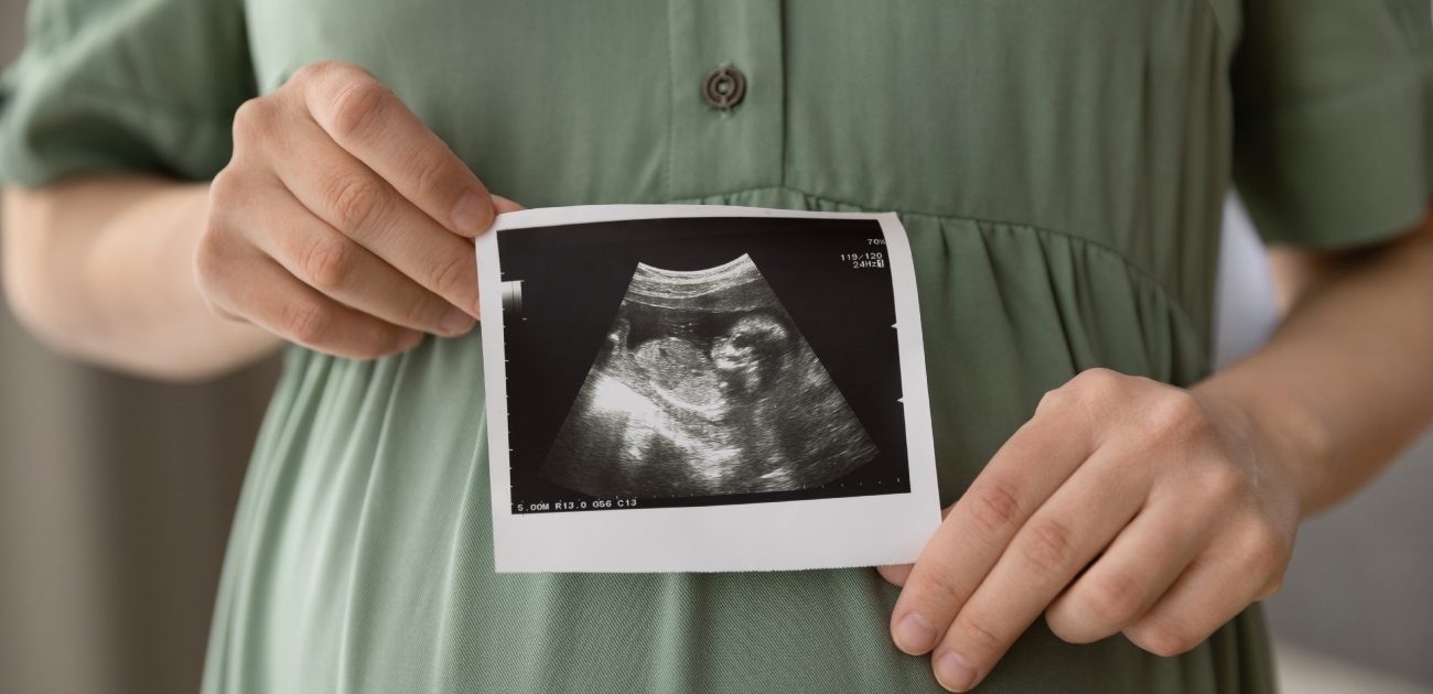 حامل تحمل صورة الجنين