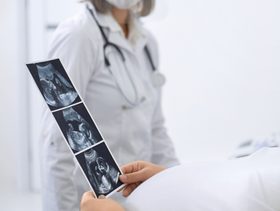 طبيبة مع الحامل والصورة التفصيلية