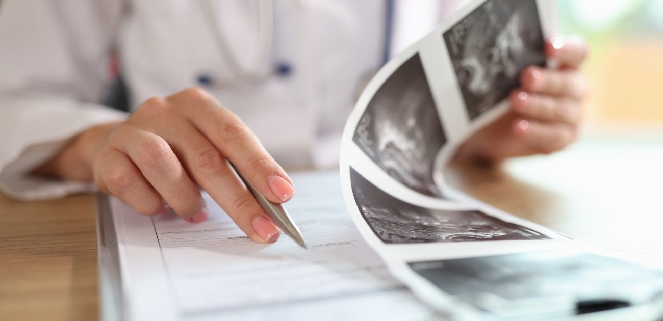 طبيبة تكشف على صور المبيض للحامل