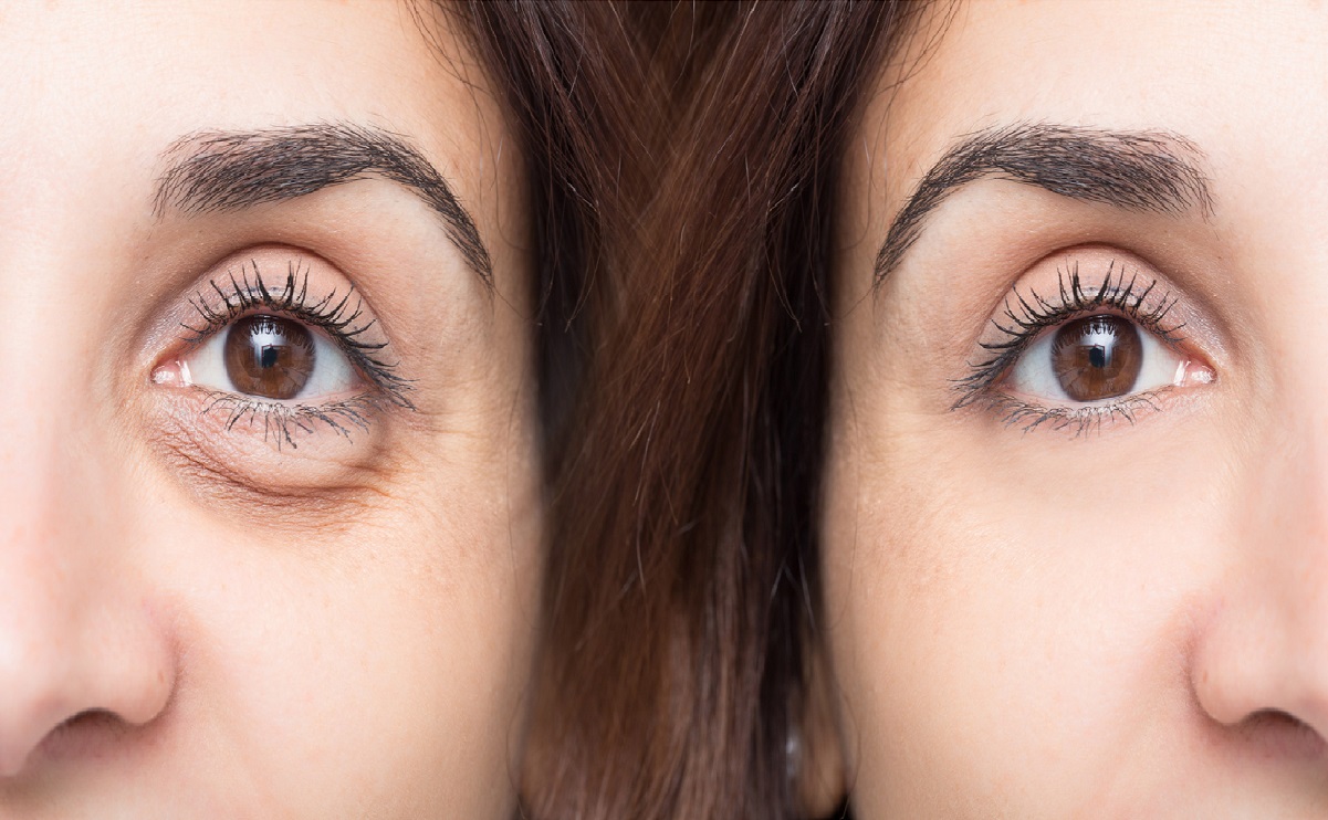 Contact Lens, Face, Person