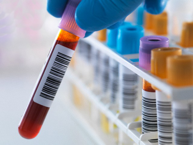 Lab, Plastic