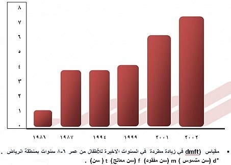 إرتفاع نسبة تسوس الأسنان بين السعوديين إلى 93%!