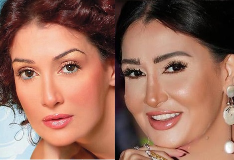 غادة عبد الرازق قبل التجميل
