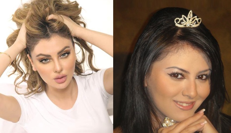 مريم حسين قبل وبعد التجميل
