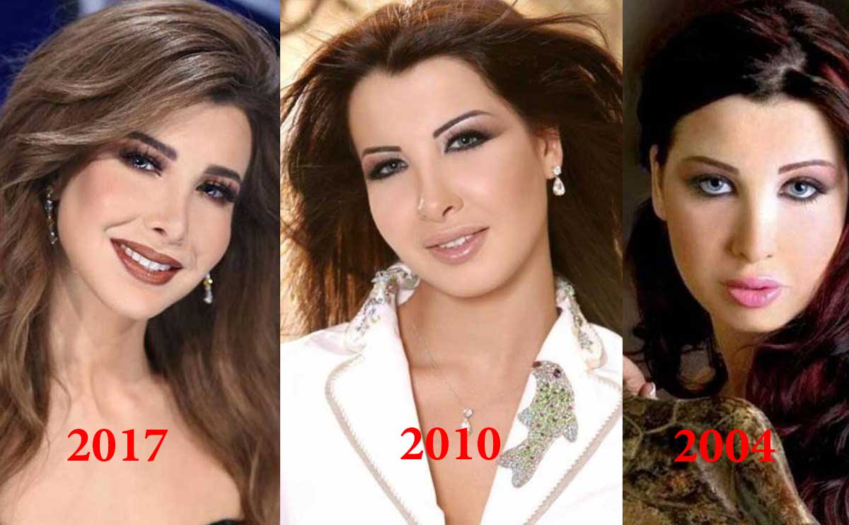 تغيير واضح في ملامح وجه نانسي عجرم وما علاقة زوجها 