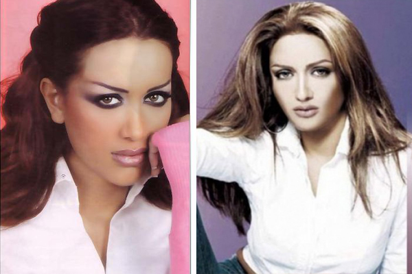 مايا دياب قبل عمليات التجميل