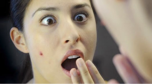 خلطة مضمونة لإزالة البثور في يوم واحد