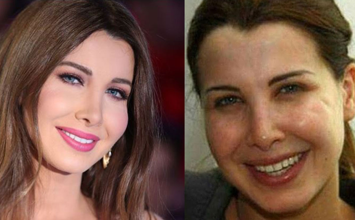 صور تؤكد ان النجمات لا يتمتعن ببشرة مثالية