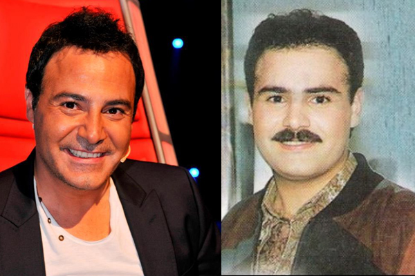 صور فنانون رجال قبل وبعد عمليات التجميل