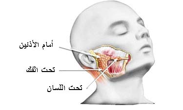 النكاف: أعراضه وعلاجه