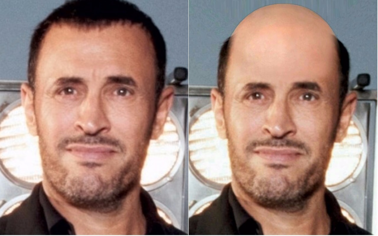 كاظم الساهر لو كان اصلعاً
