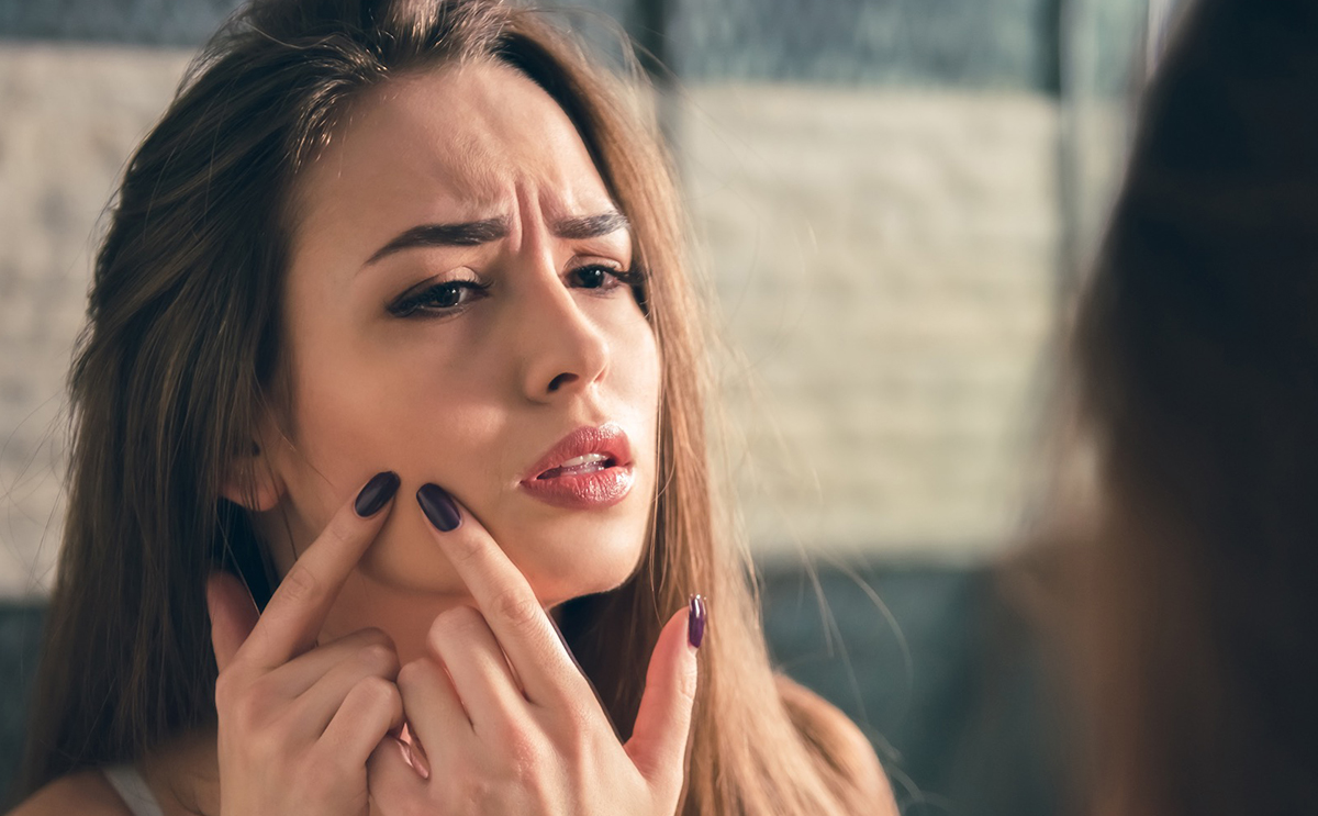 اليك طريقة علاج اثار حب الشباب بسرعة!