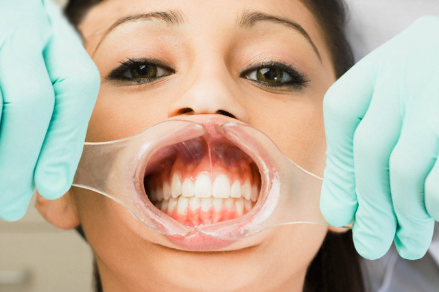 Jaw, Person, Human