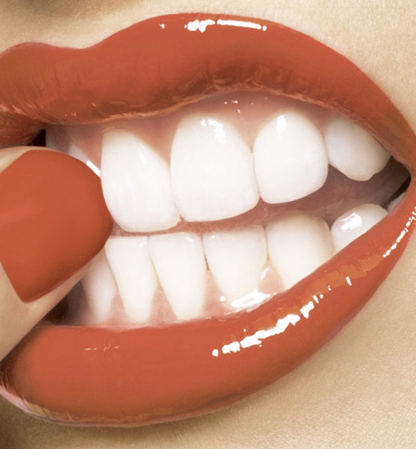 تمتعي بإبتسامة هوليوودية Hollywood Smile