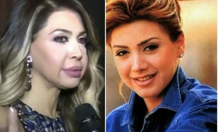 عمليات تجميل باءت بالفشل