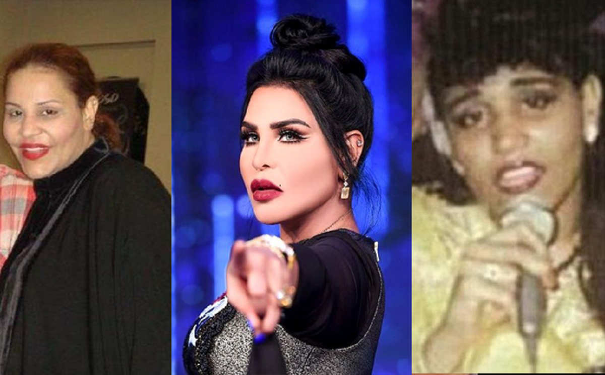 صور احلام قبل وبعد عمليات التجميل