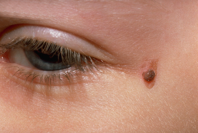 Skin, Person, Human