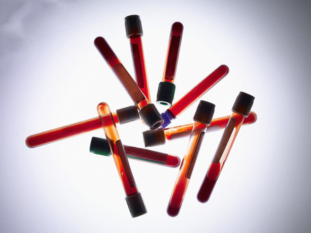 Cosmetics, Lipstick