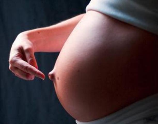 بروز السرة عند الحامل