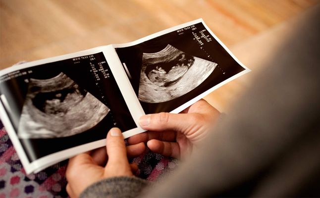 متى اسوي سونار في بدايه الحمل