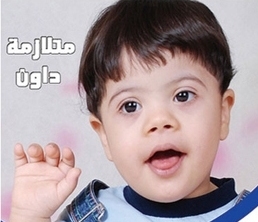 كيف تساعد الأم طفلها المصاب بمتلازمة داون؟
