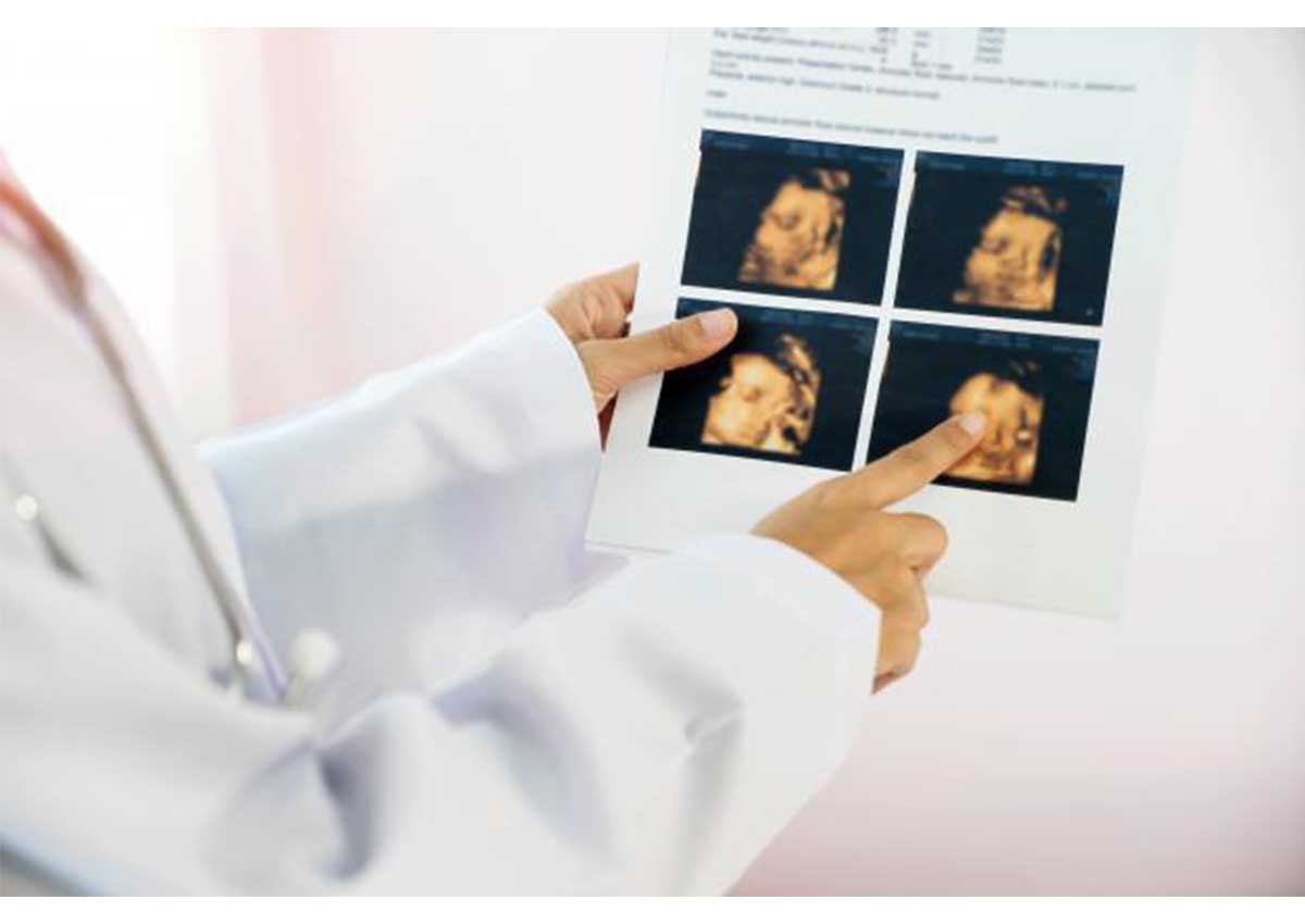 قصص واقعيه عن اخطاء السونار