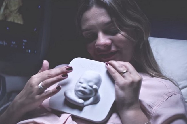 ام عمياء ترى جنينها للمرة الأولى