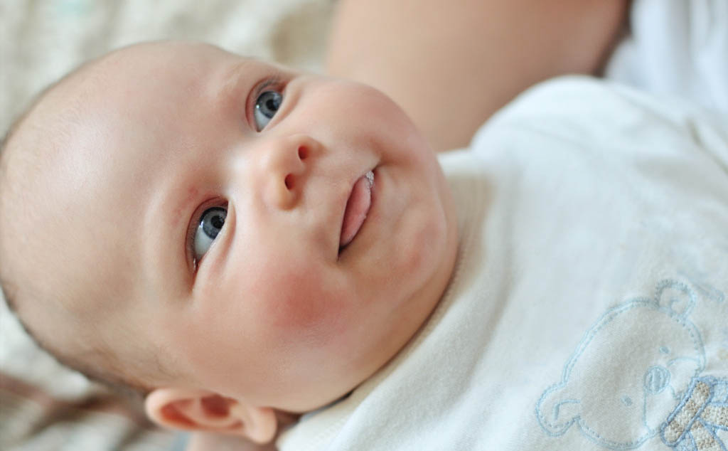 طرق علاج حساسية وجه الرضيع