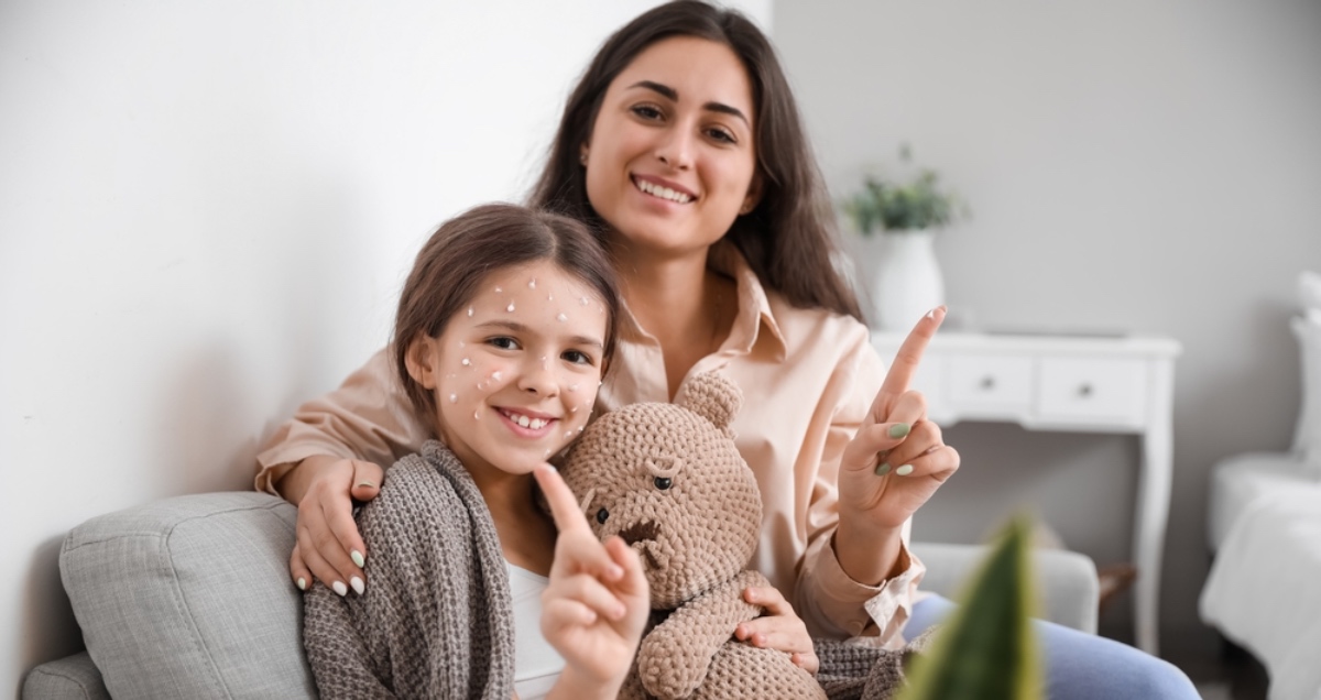 مدة علاج الجدري عند الأطفال