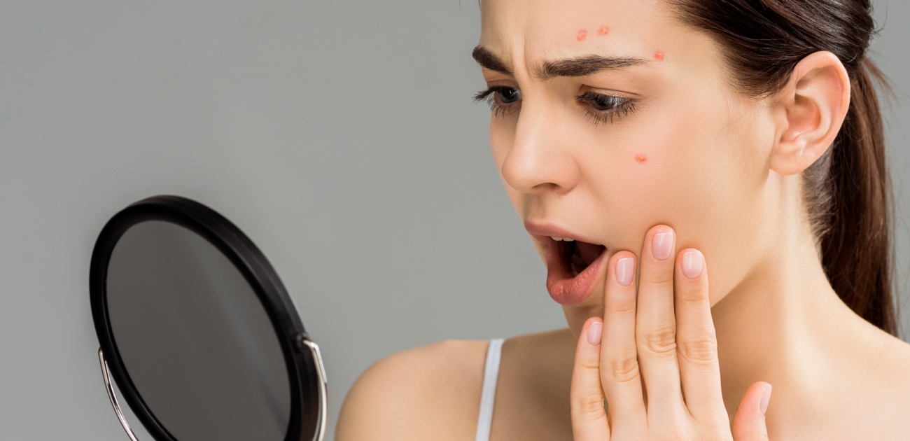 علاج حبوب الوجه الحمراء الملتهبة